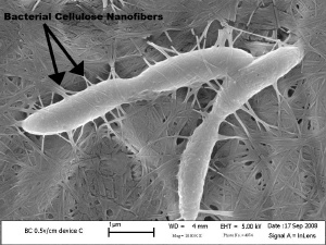 Electron microscope image of Kombucha SCOBY made of bacterial cellulose by Acetobacter Xylinum