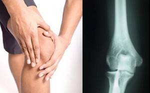 Kombucha and Joint Pain Kombucha and Joint Pain