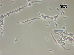 Une photographie de levure Brettanomyces montre leur forme de tige.